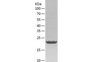 Western Blotting (WB) image for RAB6B, Member RAS Oncogene Family (RAB6B) (AA 1-208) protein (His tag) (ABIN7289025) (RAB6B Protein (AA 1-208) (His tag))