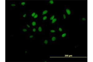 Immunofluorescence of purified MaxPab antibody to MXD3 on HeLa cell. (MXD3 antibody  (AA 1-206))