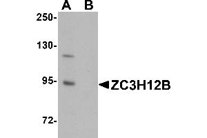 Western Blotting (WB) image for anti-Zinc Finger CCCH-Type Containing 12B (ZC3H12B) (N-Term) antibody (ABIN1031673) (ZC3H12B antibody  (N-Term))