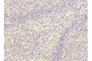 Immunohistochemistry of paraffin-embedded human tonsil tissue using ABIN7170368 at dilution of 1:100 (SNX18 antibody  (AA 449-628))