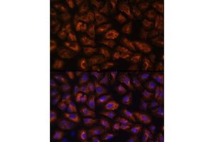Immunofluorescence analysis of U-2 OS cells using VEGFR3/FLT4 Rabbit pAb (ABIN6130780, ABIN6140699, ABIN6140702 and ABIN6221242) at dilution of 1:100 (40x lens). (FLT4 antibody  (AA 1174-1363))