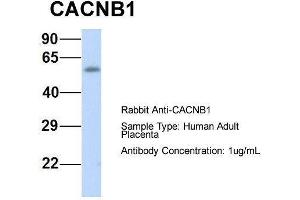 Host:  Rabbit  Target Name:  CACNB1  Sample Type:  Human Adult Placenta  Antibody Dilution:  1.