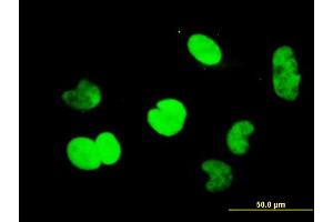 Immunofluorescence of monoclonal antibody to CTBP1 on HeLa cell. (CTBP1 antibody  (AA 1-429))
