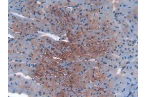 Immunohistochemistry (IHC) image for anti-Insulin-Like Growth Factor 2 Receptor (IGF2R) (AA 1148-1365) antibody (ABIN1859300)
