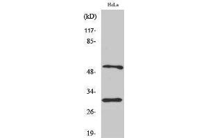 Western Blotting (WB) image for anti-Caspase 10 B/C (C-Term) antibody (ABIN3180524) (Caspase 10 B/C (C-Term) antibody)