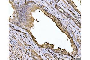 IHC analysis of Alpha Actinin 4 using anti-Alpha Actinin 4 antibody (ABIN4886421).