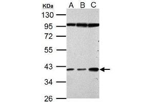 WB Image Haptoglobin antibody detects Haptoglobin protein by Western blot analysis. (Haptoglobin antibody)