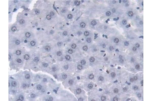 TKT Antikörper  (AA 1-286)