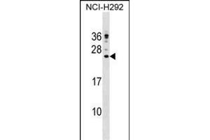 CP Antibody (C-term) (ABIN1536685 and ABIN2848635) western blot analysis in NCI- cell line lysates (35 μg/lane). (Cathelicidin antibody  (C-Term))