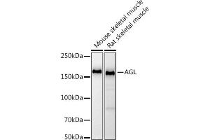 Western blot analysis of extracts of various cell lines, using (ABIN7265574) at 1:1000 dilution. (AGL antibody)