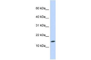 UBE2D3 antibody used at 1 ug/ml to detect target protein. (UBE2D3 antibody)