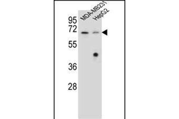 GLMN Antikörper  (C-Term)