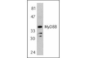 Western blot analysis of MyD88 in Jurkat whole cell lysate with this product at 1 μg/ml.