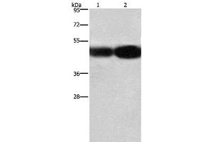 Western Blot analysis of A549 and 231 cell using BSG Polyclonal Antibody at dilution of 1:430 (CD147 antibody)