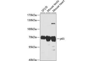 Western blot analysis of extracts of various cell lines, using p63 antibody (ABIN6133472, ABIN6149425, ABIN6149428 and ABIN6216786) at 1:3000 dilution. (p63 antibody  (AA 1-160))