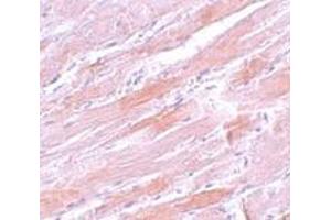 Immunohistochemistry (IHC) image for anti-Isocitrate Dehydrogenase 2 (NADP+), Mitochondrial (IDH2) (N-Term) antibody (ABIN1031407) (IDH2 antibody  (N-Term))