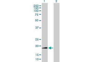 Western Blot analysis of RNF185 expression in transfected 293T cell line by RNF185 MaxPab polyclonal antibody. (RNF185 antibody  (AA 1-192))