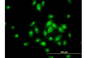 Immunofluorescence of monoclonal antibody to MGC16169 on HeLa cell. (TBCK antibody  (AA 601-700))