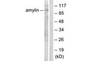 Western blot analysis of extracts from HeLa cells, treated with EGF 200ng/ml 30', using Amylin Antibody.