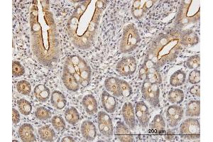 Immunoperoxidase of purified MaxPab antibody to KLK2 on formalin-fixed paraffin-embedded human small Intestine. (Kallikrein 2 antibody  (AA 1-223))