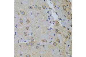Immunohistochemistry of paraffin-embedded mouse brain using GM13125 antibody (ABIN6127294, ABIN6141172, ABIN6141175 and ABIN6216319) at dilution of 1:100 (40x lens). (Pramel15 antibody  (AA 1-477))
