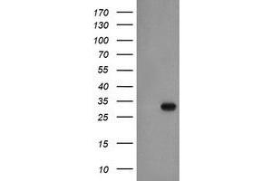 HEK293T cells were transfected with the pCMV6-ENTRY control (Left lane) or pCMV6-ENTRY EXOSC3 (Right lane) cDNA for 48 hrs and lysed. (EXOSC3 antibody)