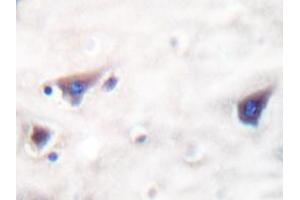 Immunohistochemistry analyzes of KSR antibody in paraffin-embedded human brain tissue. (KSR1 antibody)