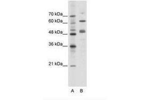 Image no. 1 for anti-GATA Binding Protein 4 (GATA4) (N-Term) antibody (ABIN6736111) (GATA4 antibody  (N-Term))