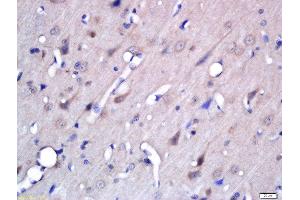 Formalin-fixed and paraffin embedded rat brain labeled with Rabbit Anti-BACE2 Polyclonal Antibody, Unconjugated (ABIN2170478) at 1:200 followed by conjugation to the secondary antibody and DAB staining (BACE2 antibody  (AA 101-200))