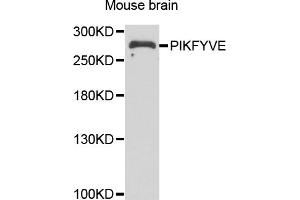 Western blot analysis of extracts of mouse brain, using PIKFYVE antibody.
