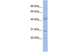 WB Suggested Anti-CCNE2  Antibody Titration: 0. (Cyclin E2 antibody  (N-Term))