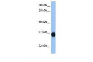 Image no. 1 for anti-RAB3D, Member RAS Oncogene Family (RAB3D) (C-Term) antibody (ABIN322258) (RAB3D antibody  (C-Term))
