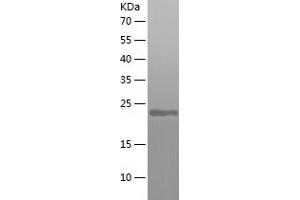 Western Blotting (WB) image for ADP-Ribosylation Factor 6 (ARF6) (AA 1-175) protein (His tag) (ABIN7283466) (ARF6 Protein (AA 1-175) (His tag))