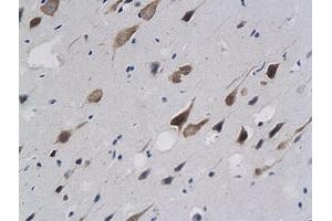 Formalin-fixed and paraffin embedded rat brain labeled with anti-Calponin 1/COLP Polyclonal Antibody (ABIN724820), Unconjugated followed by conjugation to the secondary antibody and DAB staining