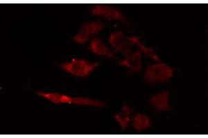 Immunofluorescence (fixed cells) (IF/ICC) image for anti-Cytochrome B5 Type A (Microsomal) (CYB5A) (Internal Region) antibody (ABIN6259625)