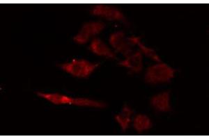 ABIN6274680 staining A549 cells by IF/ICC.