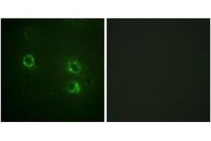 Immunofluorescence analysis of COS7 cells, using Synapsin1 (Ab-605) Antibody.
