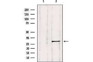 Western blot analysis of extracts from HepG2, using Rab 11B Antibody.