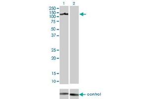 Western blot analysis of AXL over-expressed 293 cell line, cotransfected with AXL Validated Chimera RNAi (Lane 2) or non-transfected control (Lane 1). (AXL antibody  (AA 30-140))