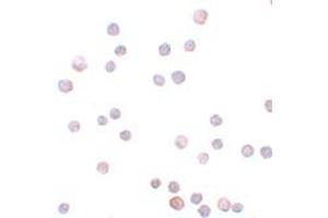 Immunohistochemistry (IHC) image for anti-Zinc Finger E-Box Binding Homeobox 1 (ZEB1) (Middle Region) antibody (ABIN1031173) (ZEB1 antibody  (Middle Region))