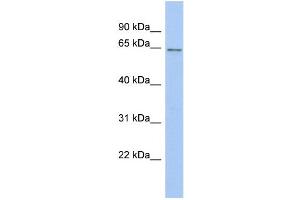 WB Suggested Anti-SMARCD2 Antibody Titration: 0.
