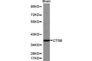 Western Blotting (WB) image for anti-Cathepsin B (CTSB) antibody (ABIN1872095) (Cathepsin B antibody)