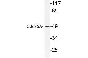 Western blot (WB) analysis of Cdc25A antibody in extracts from Jurkat cells. (CDC25A antibody)