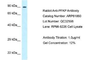 Western Blotting (WB) image for anti-phosphofructokinase, Platelet (PFKP) (C-Term) antibody (ABIN2788927) (PFKP antibody  (C-Term))