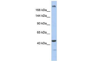 KIAA0284 antibody used at 1 ug/ml to detect target protein. (KIAA0284 antibody  (N-Term))
