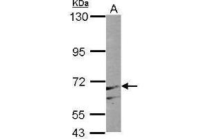 PAPSS1 antibody