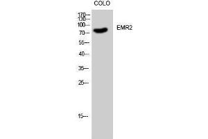 EMR2 antibody  (C-Term)