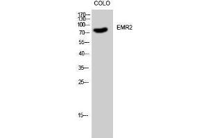 Western Blotting (WB) image for anti-Egf-Like Module Containing, Mucin-Like, Hormone Receptor-Like 2 (EMR2) (C-Term) antibody (ABIN3184475)