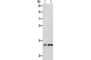 Western Blotting (WB) image for anti-Interleukin 1 Receptor-Like 1 (IL1RL1) antibody (ABIN2428923) (IL1RL1 antibody)