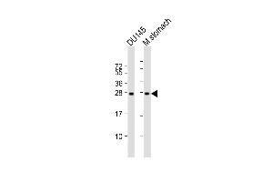 Lane 1: DU145 Cell lysates, Lane 2: mouse stomach Cell lysates, probed with RAB27B (1596CT245. (RAB27B antibody)